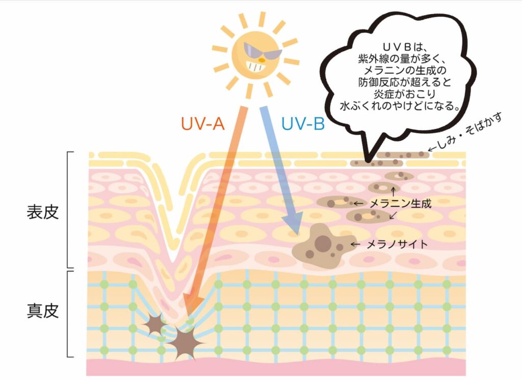 UVBの影響
