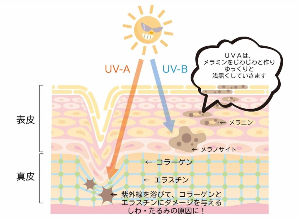 UVAの影響