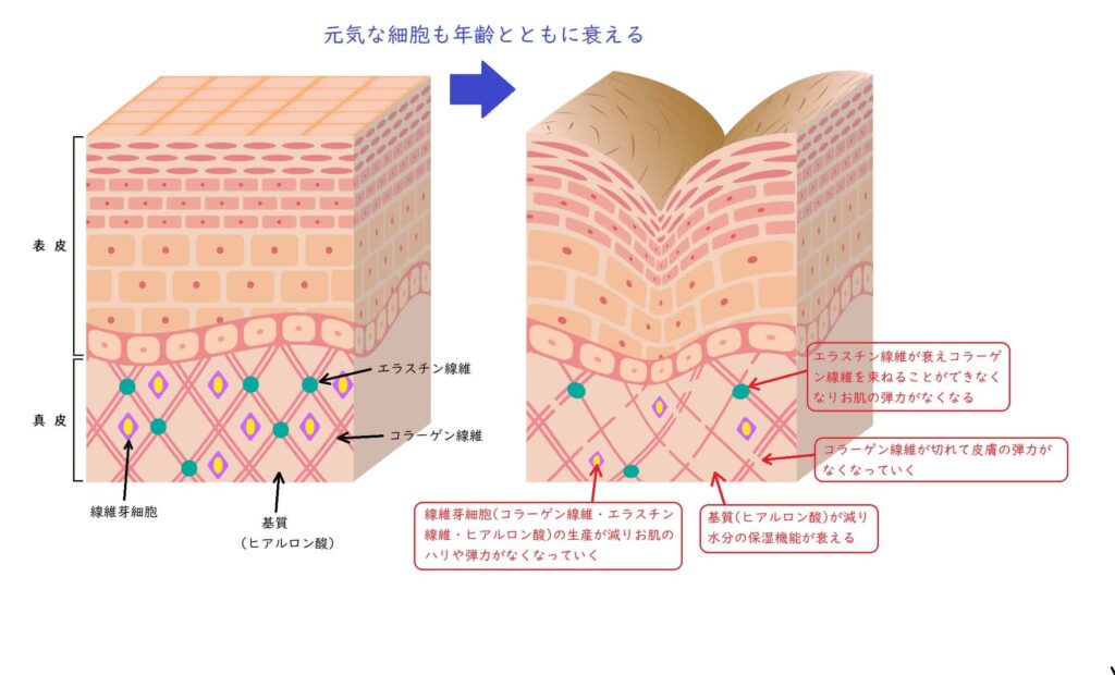 真皮の衰え